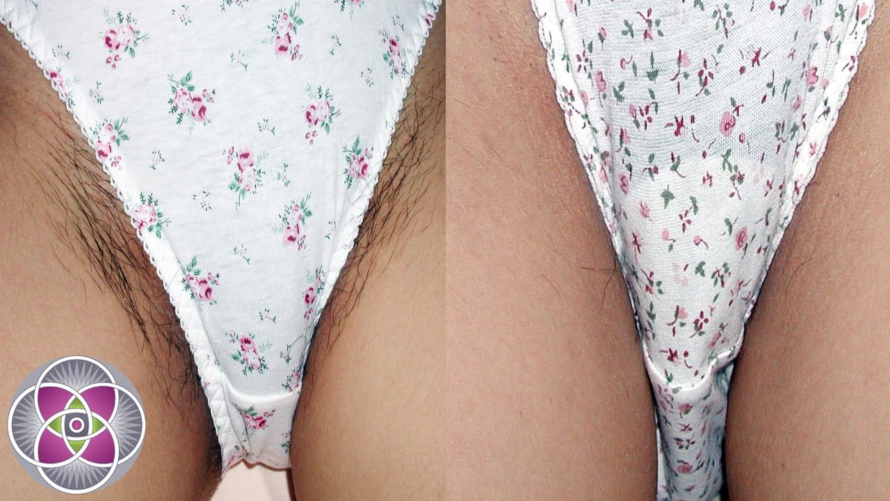 Laser Hair Removal Before and After