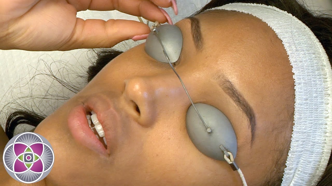 Laser Hair Removal for Dark Skin with YAG Laser